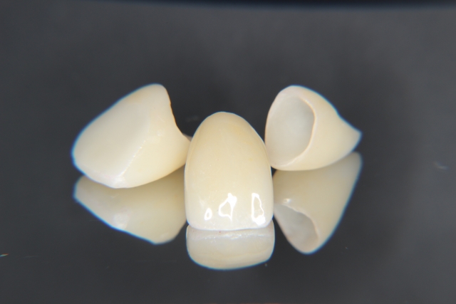 E-MAX（オールセラミックス）