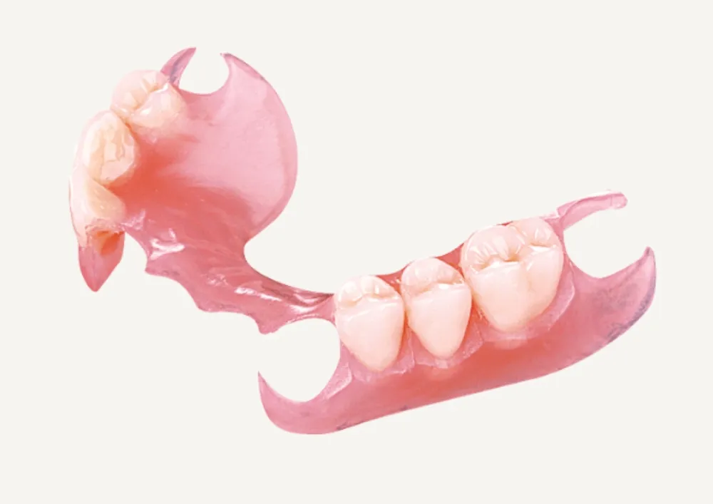 ノンクラスプデンチャー